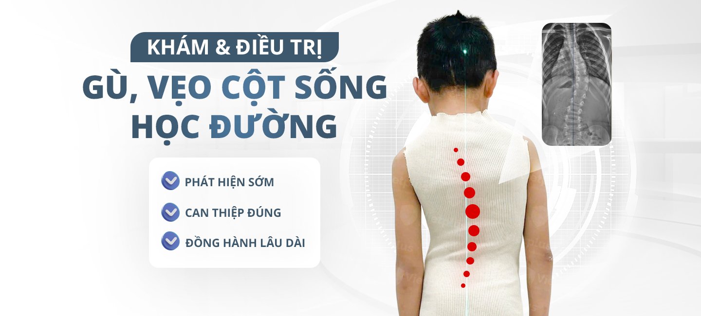 Khám và đièu trị gù, vẹo cột sống học đường